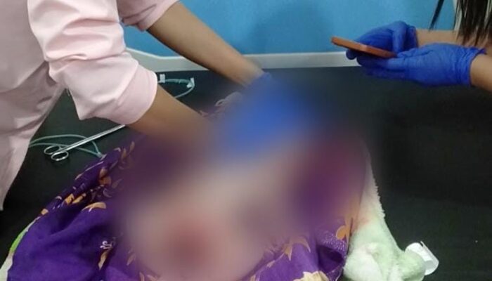 Polres Simalungun Selidiki Kasus Bayi yang Ditemukan Terlantar di Kebun Teh Sidamanik