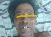 Polres Simalungun Himbau Warga Bantu Identifikasi Korban Laka Lantas ODGJ “Mr. X”