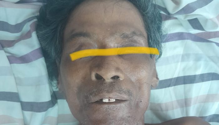 Polres Simalungun Himbau Warga Bantu Identifikasi Korban Laka Lantas ODGJ “Mr. X”