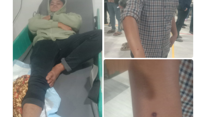 Polres Simalungun Tangkap Pelaku Penembakan Rorinata, Lima Warga Jadi Korban