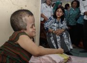 Ny Liswati Wesly Silalahi Beri Bantuan untuk Sukma, Penderita Hidrosefalus Sejak Lahir