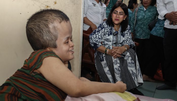 Ny Liswati Wesly Silalahi Beri Bantuan untuk Sukma, Penderita Hidrosefalus Sejak Lahir